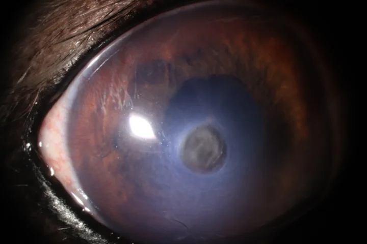 각막 천공 결막이식술 치료 전