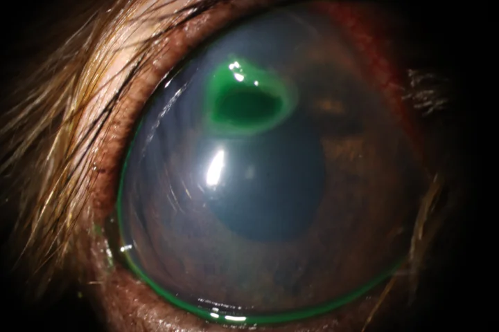 깊은 각막 궤양 결막이식술 치료 전