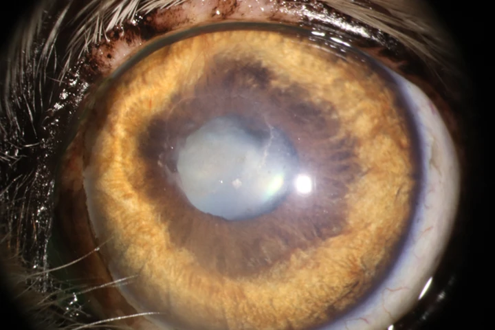 각막 궤양-각막 변성증 치료 후