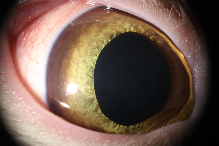 안검 열상 치료 후