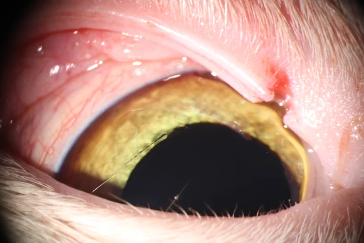 안검 열상 치료 전