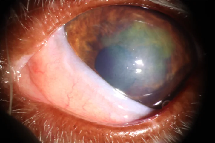 난치성 각막 궤양 치료 전